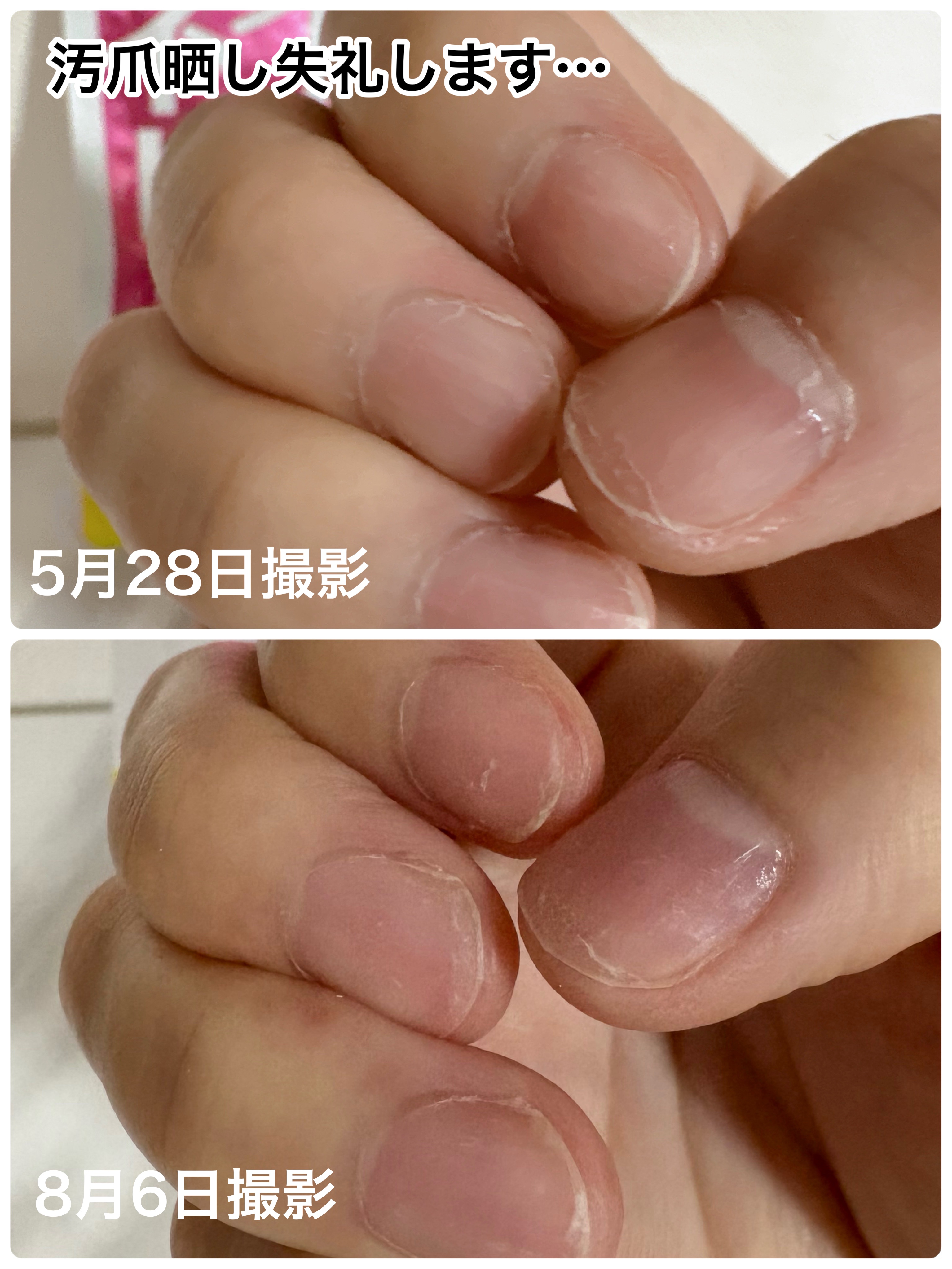 ネイリッチ/DHC/健康サプリメントを使ったクチコミ（2枚目）