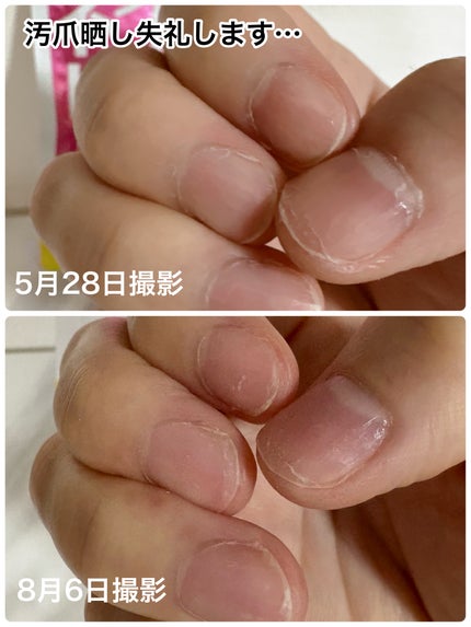 ネイリッチ/DHC/健康サプリメントを使ったクチコミ(2枚目)