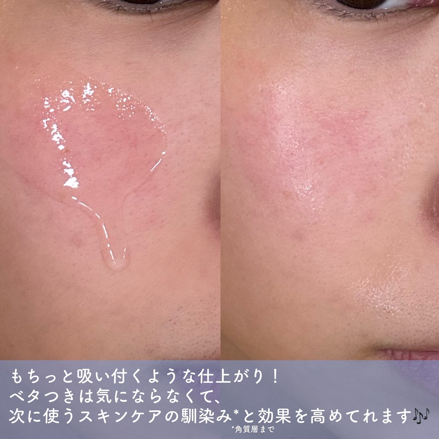 スネイルソリューション スキンブースター(R)/ネイチャーリパブリック/ブースター・導入液を使ったクチコミ(3枚目)