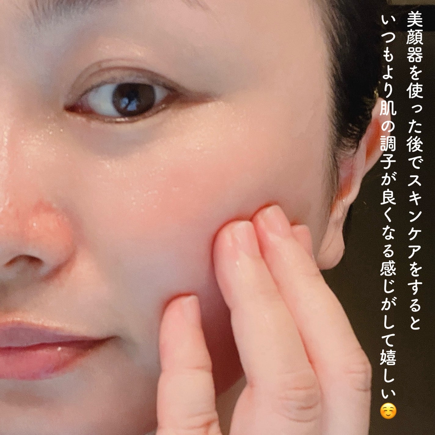 プラズマショットブースター/manyo/美顔器・マッサージを使ったクチコミ(5枚目)