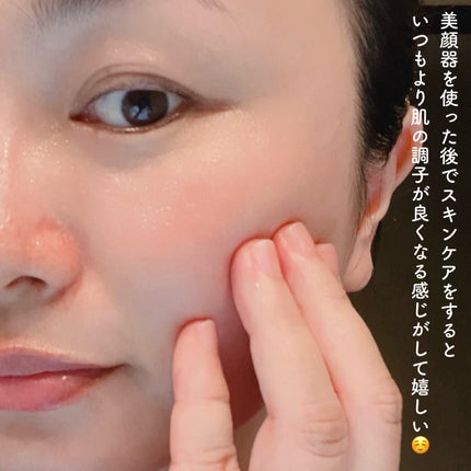 プラズマショットブースター/manyo/美顔器・マッサージを使ったクチコミ(5枚目)