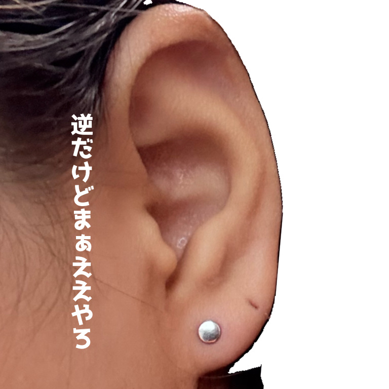 ドルマイシン軟膏(医薬品)/ゼリア新薬工業/その他を使ったクチコミ（3枚目）