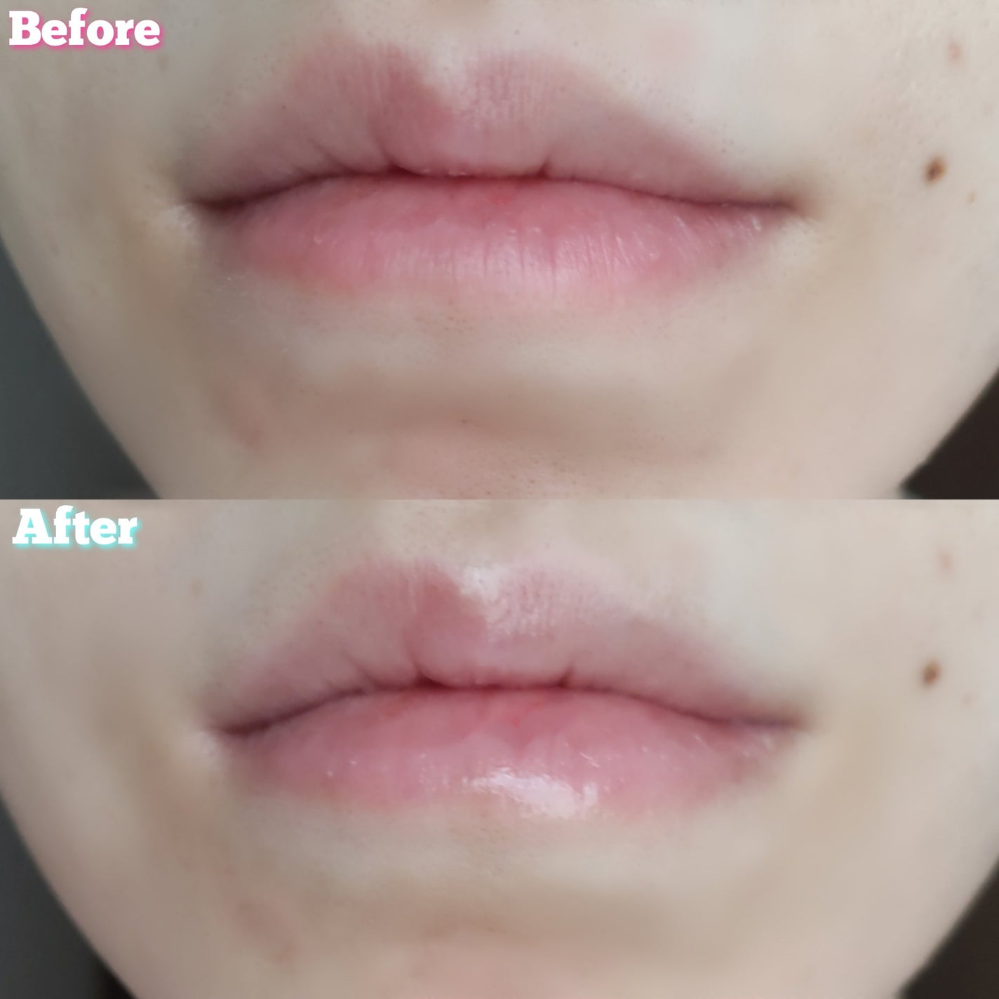 ビオリカ ボタニカル&ライス配合モイスチャーリップ/BIORICA(ビオリカ)/リップケアを使ったクチコミ(6枚目)