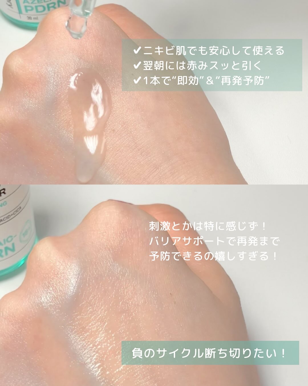 ダーマアンサーアゼライン酸ミントアンプル/CNP Laboratory/美容液を使ったクチコミ（3枚目）