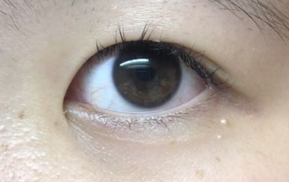 アーティラル UV＆モイスト ワンデー/ARTIRAL/ワンデー（１DAY）カラコンを使ったクチコミ（2枚目）