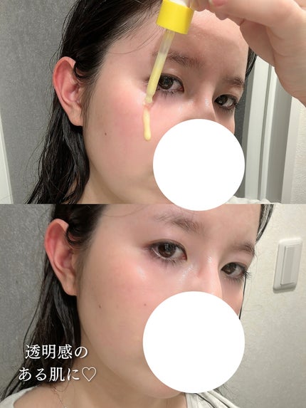 ビタミンC15%スーパーブラストアンプル/ZIGTAG/美容液を使ったクチコミ(4枚目)