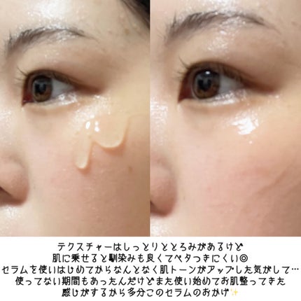 7モイスチャーブライトニングアンプルマスク/Real Barrier/シートマスク・パックを使ったクチコミ(4枚目)