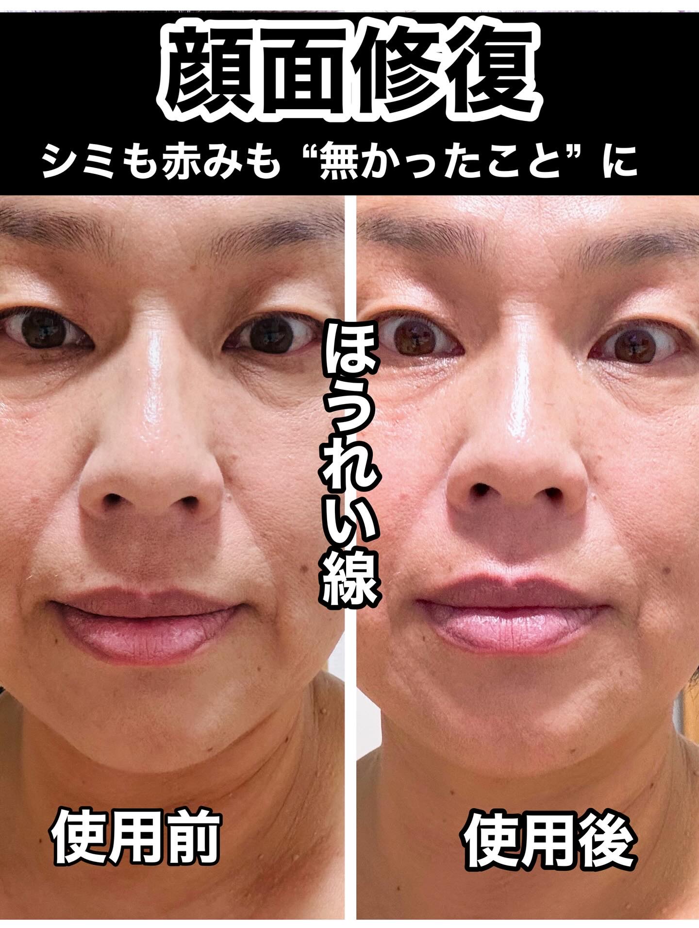 THE TOOL LAB 超密着コンシールデュオ/THE TOOL LAB/その他キットセットを使ったクチコミ（2枚目）