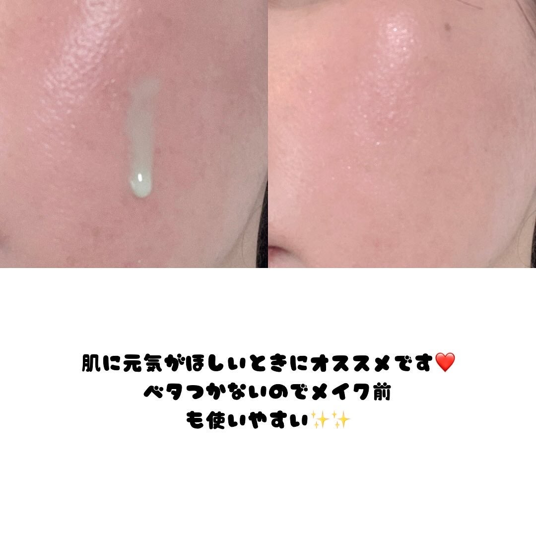 ReDRNエクソソームアンプル/Dr.nineteen/美容液を使ったクチコミ(3枚目)