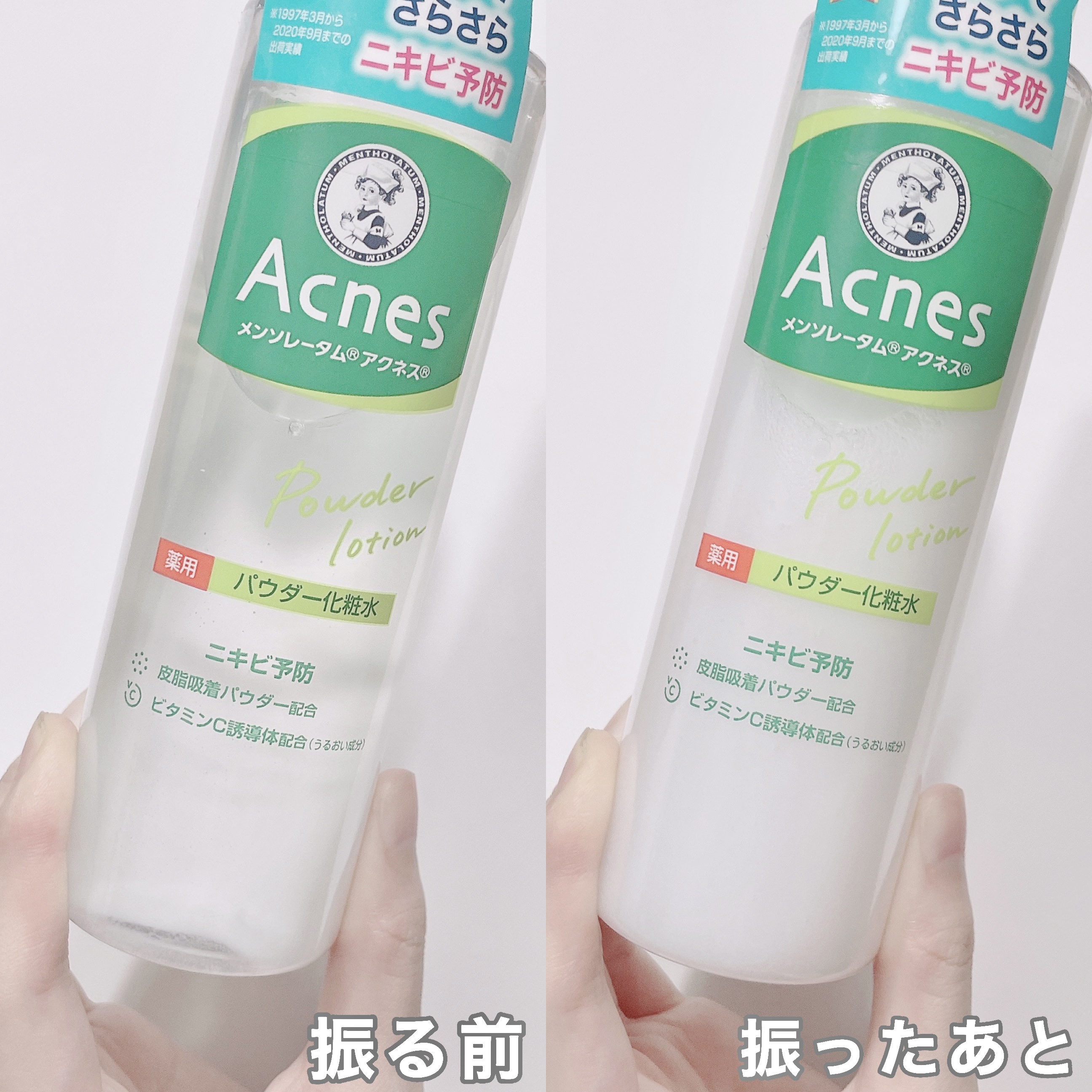 薬用パウダー化粧水/メンソレータム アクネス/化粧水を使ったクチコミ（2枚目）