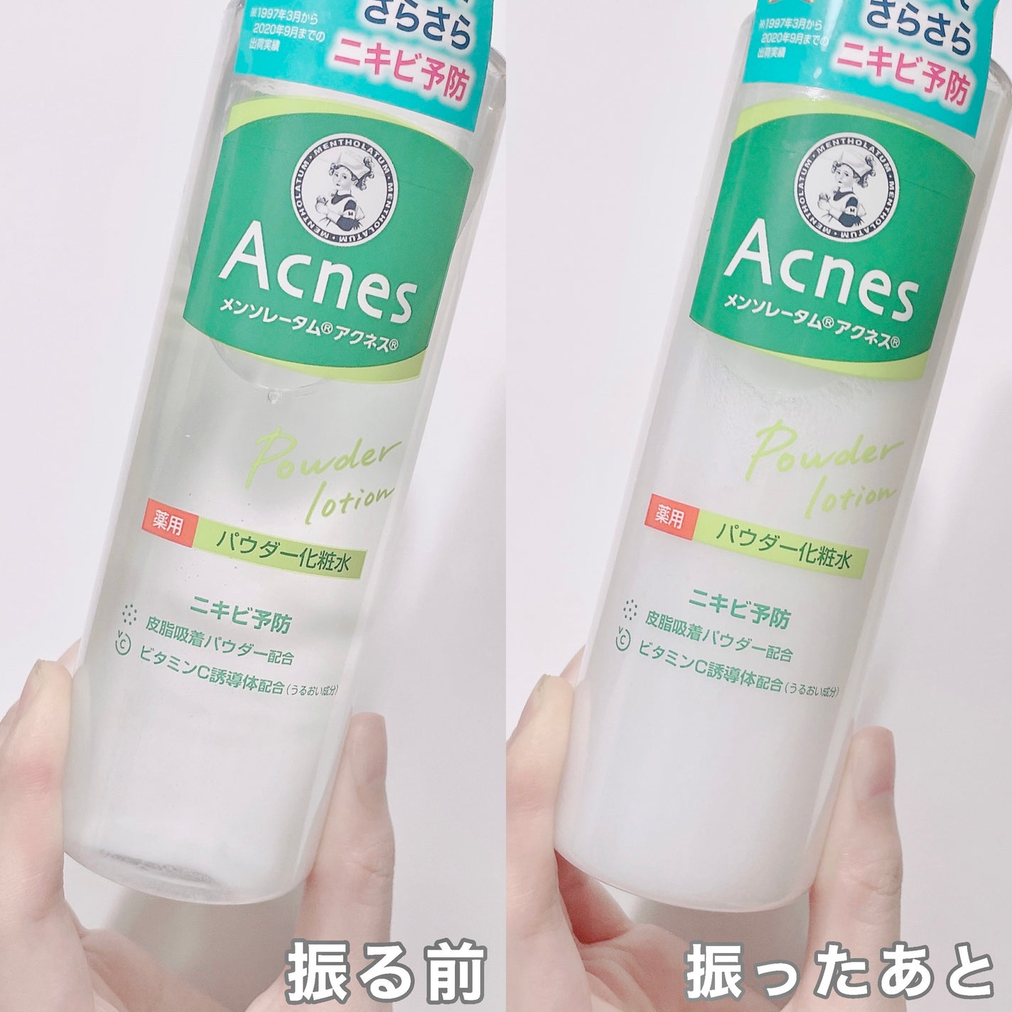 薬用パウダー化粧水/メンソレータム アクネス/化粧水を使ったクチコミ(2枚目)