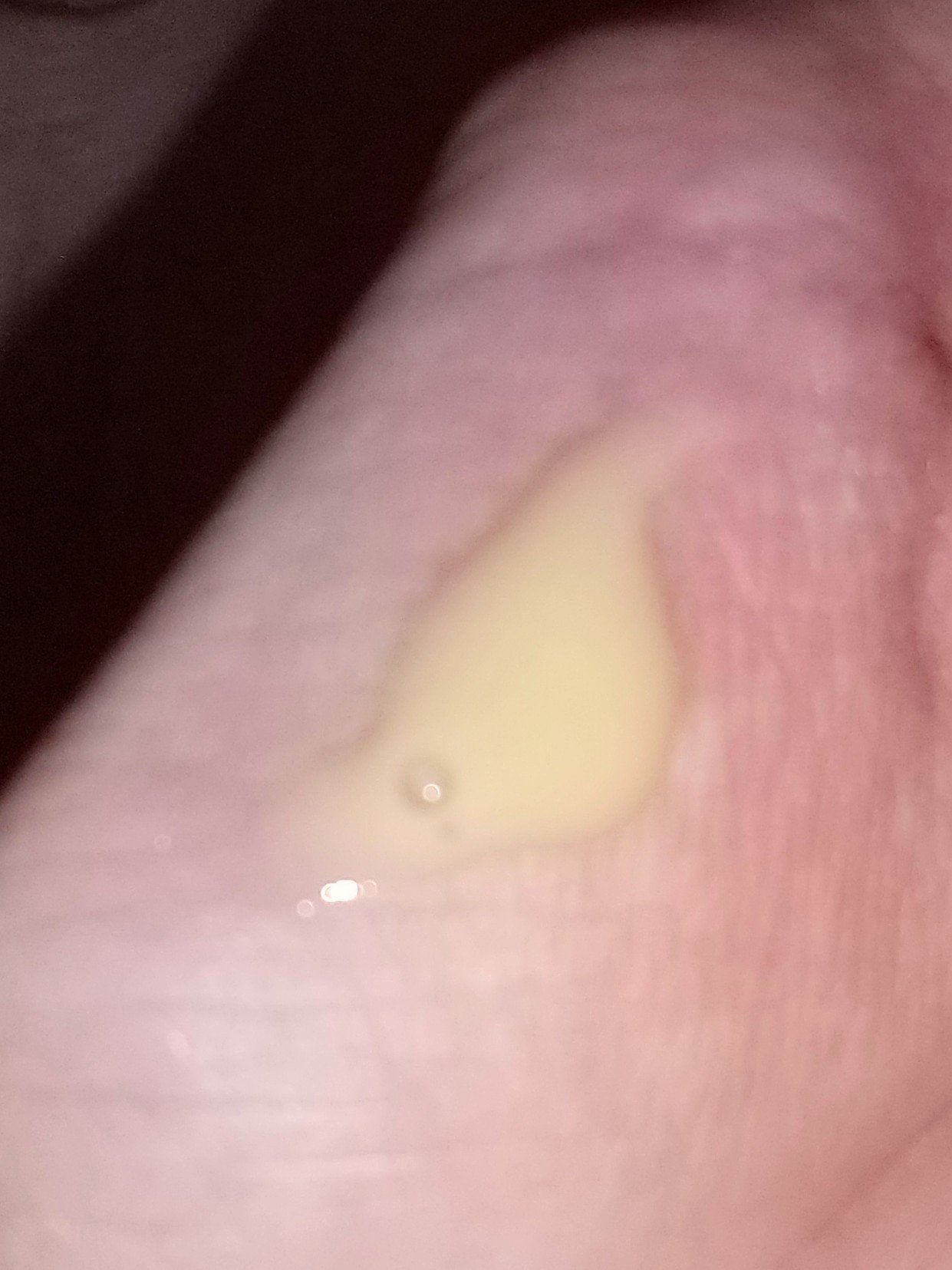 ビタエイジングピュアC セラムトナー/VARI:HOPE/化粧水を使ったクチコミ（3枚目）