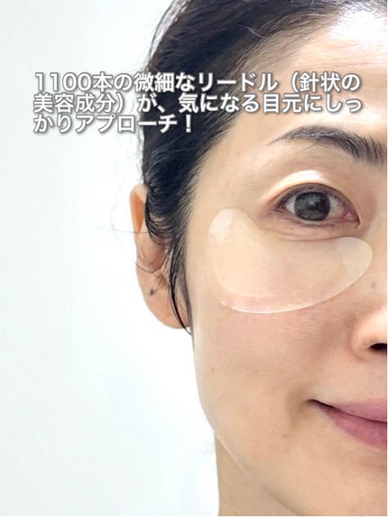 やんみ on LIPS 「【1100ショットアイリフティングリードルパッチ】極細のマイク..」(5枚目)