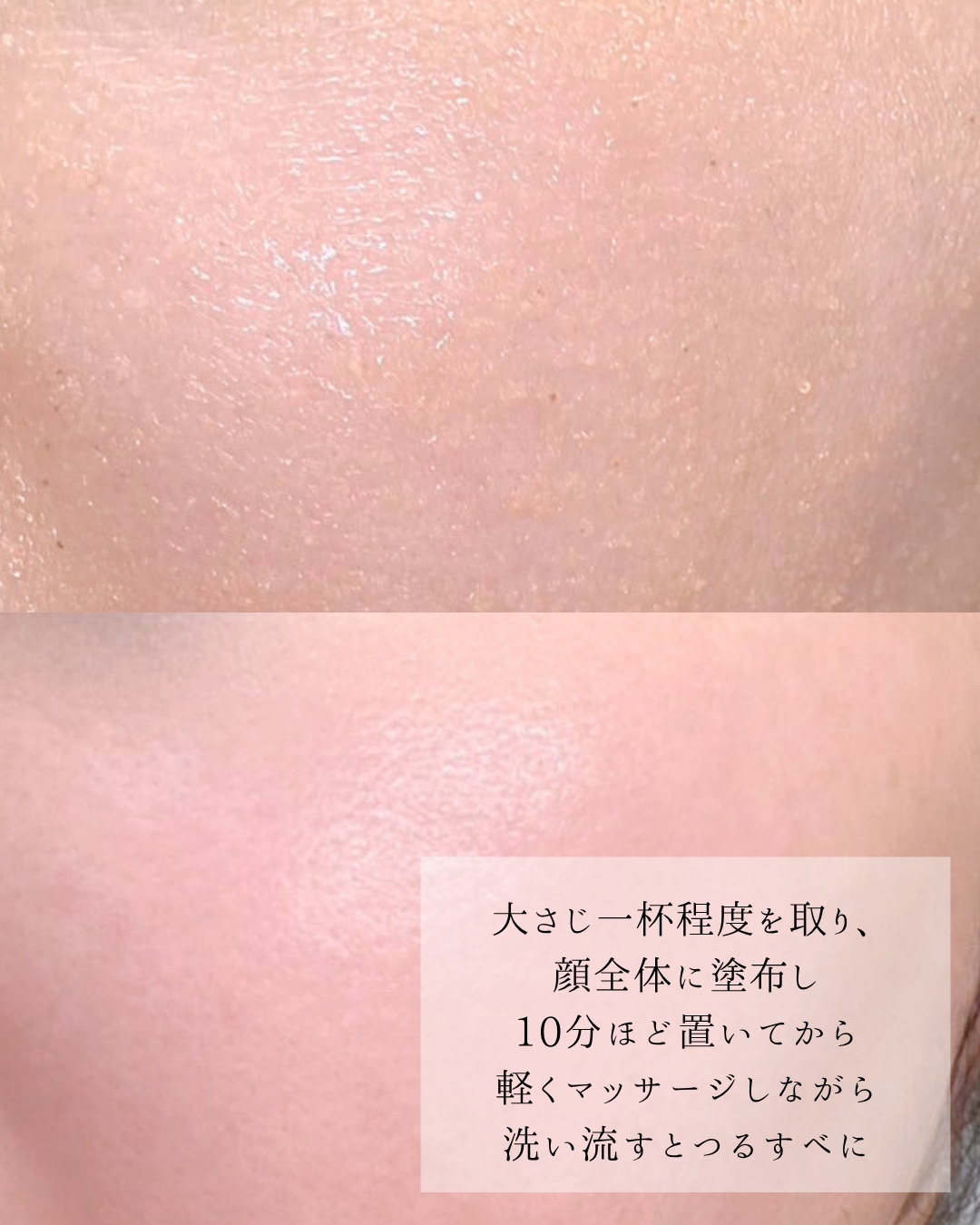 えむ。 投稿ある方ﾌｫﾛﾊﾞ100ﾘﾑﾊﾞ100のクチコミ「韓国の霊岩(ヨンアム)っていうところの
イチジクを使用し作られたバーム
イチジク酵素がメイク汚.....」（3枚目）