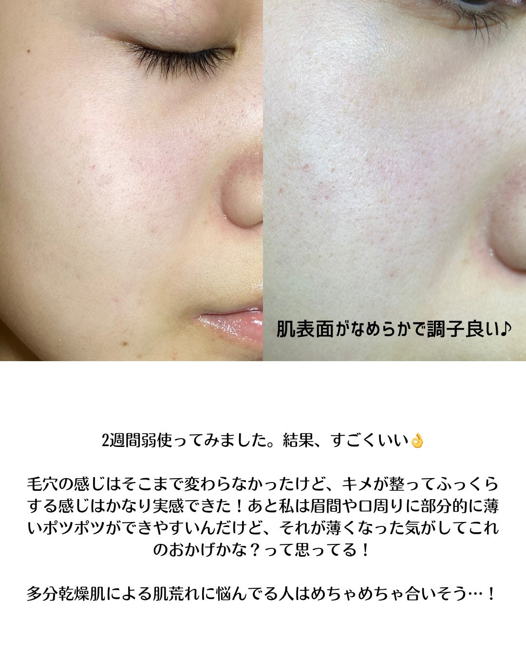 NMN-PDRN ダーマアンサー ポア ファーミング アンプル/CNP Laboratory/美容液を使ったクチコミ(4枚目)