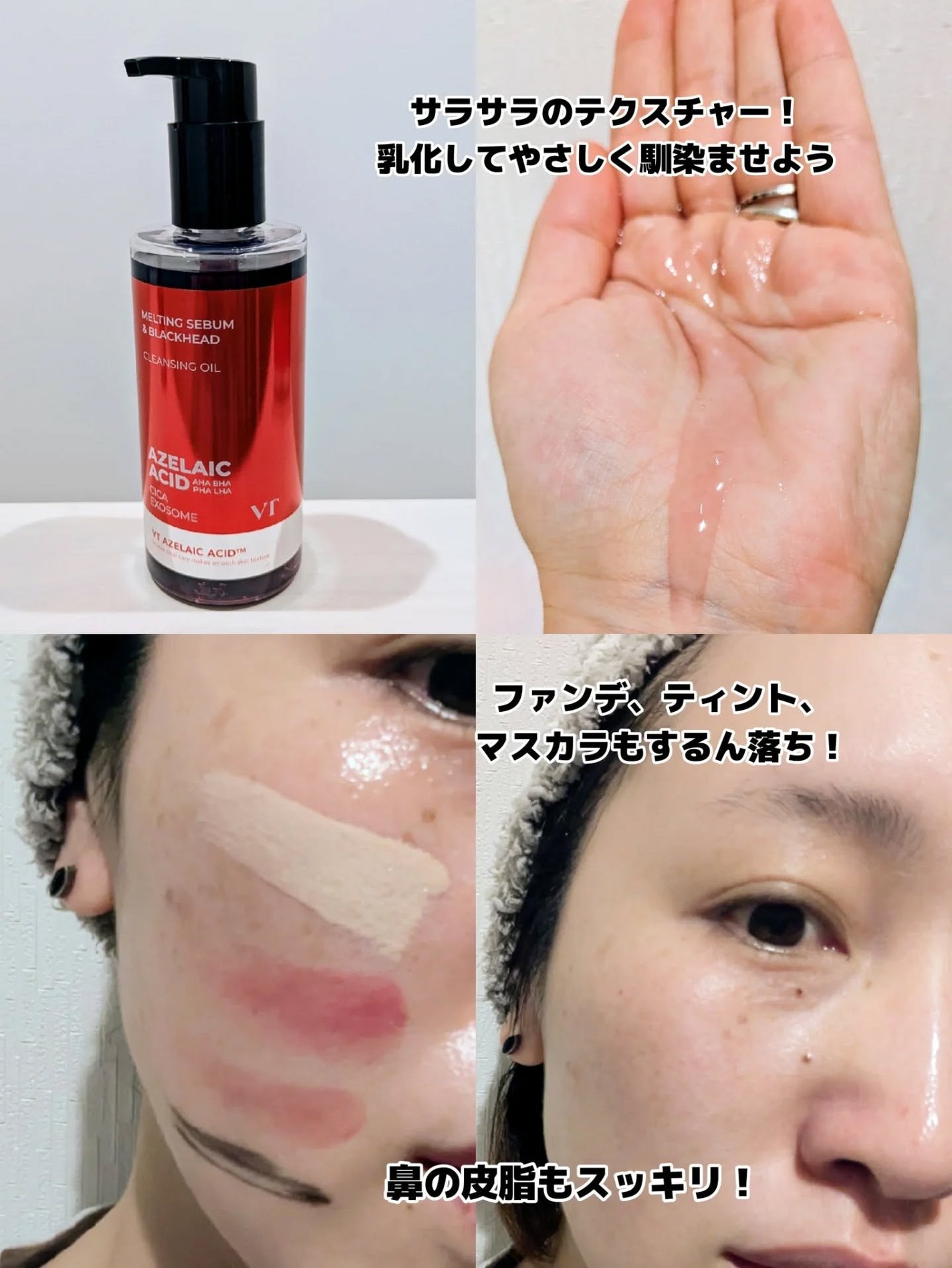 みそだんごちゃん on LIPS 「VTのアゼライン酸アイテム使ったことある?@vtcosmeti..」(3枚目)