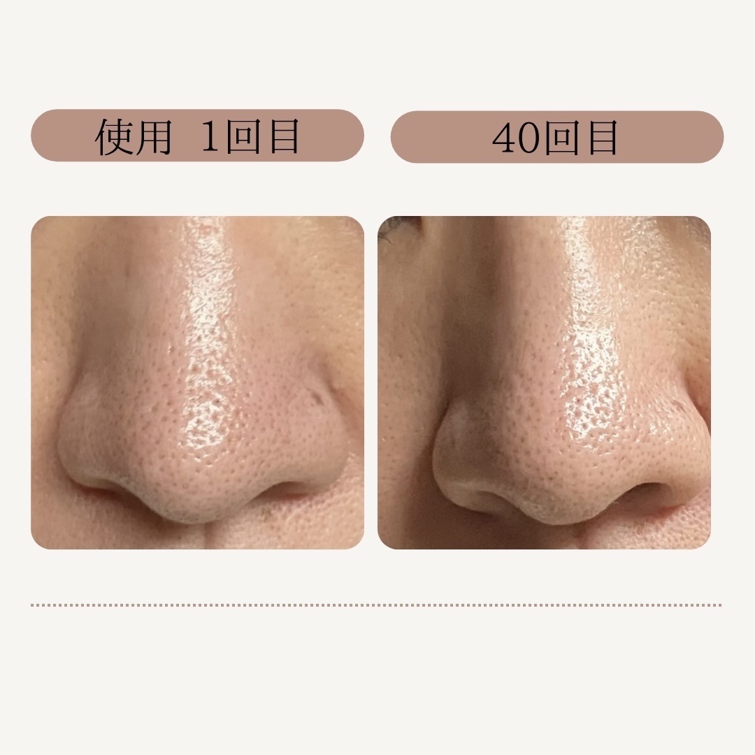 AQ 毛穴美容液オイル/DECORTÉ/フェイスオイルを使ったクチコミ（2枚目）