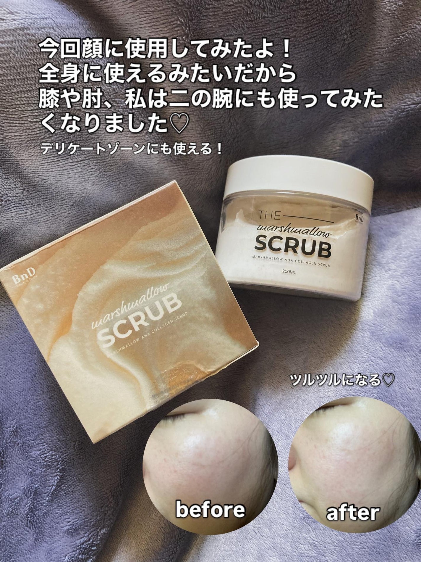 BnD マシュマロ コラーゲン AHA スクラブ /BnD/ボディスクラブを使ったクチコミ(4枚目)