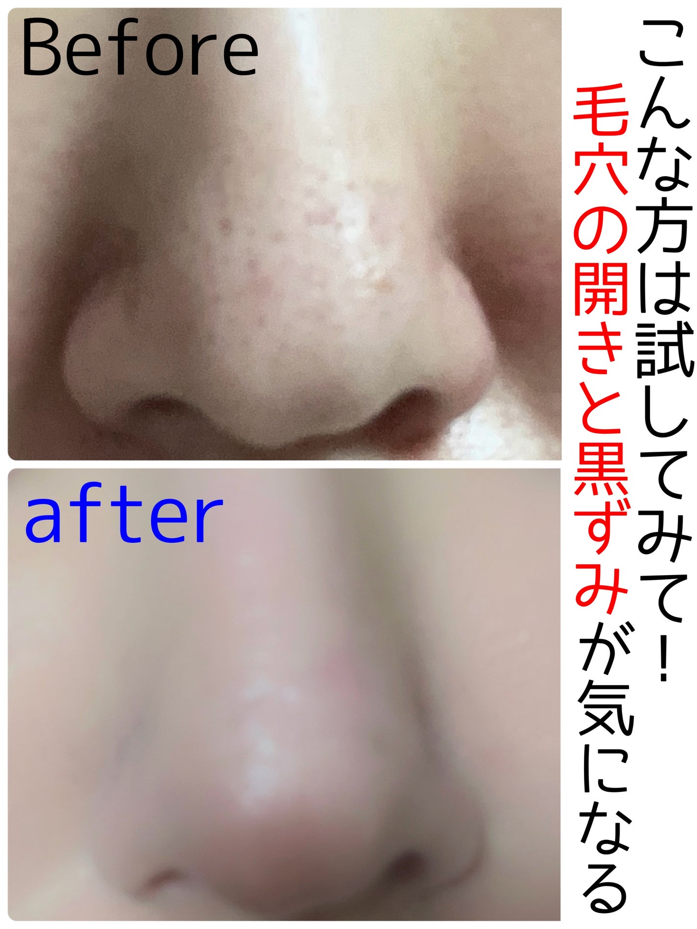 リポピールセラム/LIPOPEEL/美容液を使ったクチコミ(1枚目)