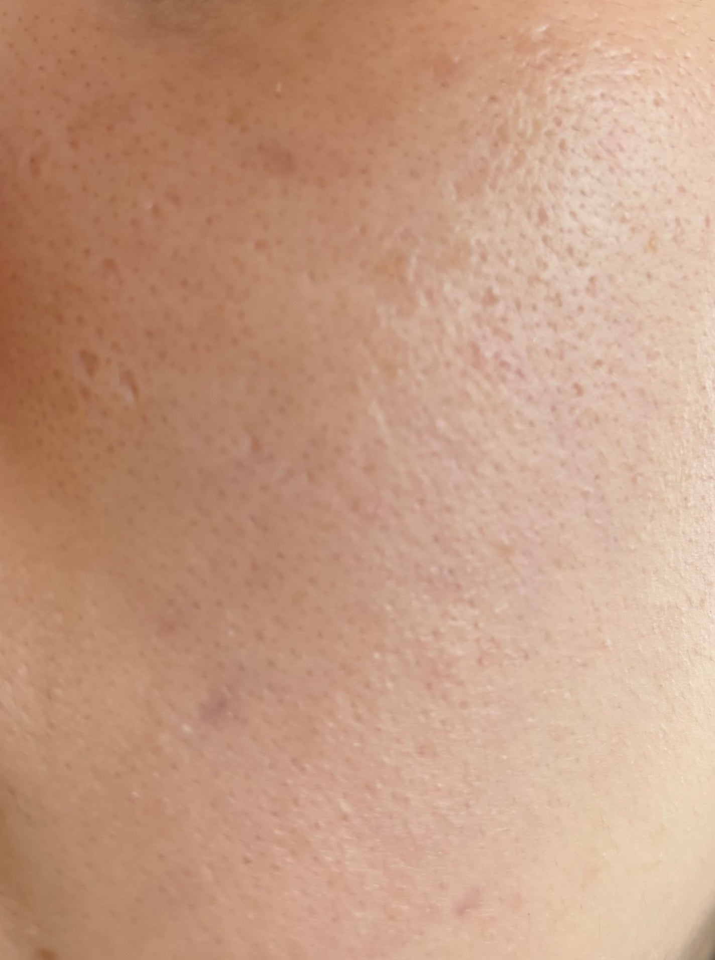 薬用Wホワイトエッセンス/透明白肌/美容液を使ったクチコミ(2枚目)