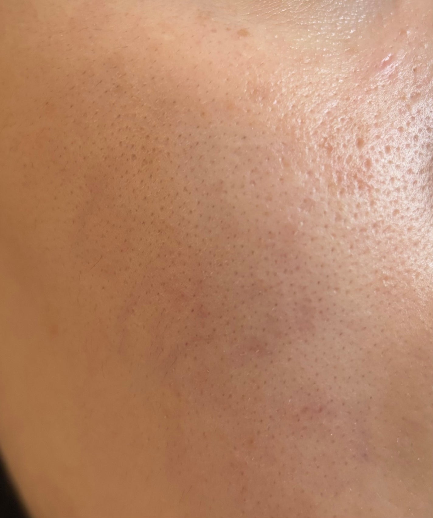 薬用Wホワイトエッセンス/透明白肌/美容液を使ったクチコミ(1枚目)