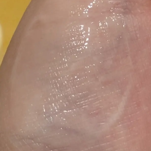 ビタエイジング ピュアビタミンC クリーム/VARI:HOPE/フェイスクリームを使ったクチコミ（2枚目）