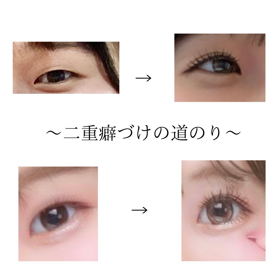 ワンダーアイリッドテープ Extra/D-UP/二重まぶた用アイテムを使ったクチコミ（1枚目）