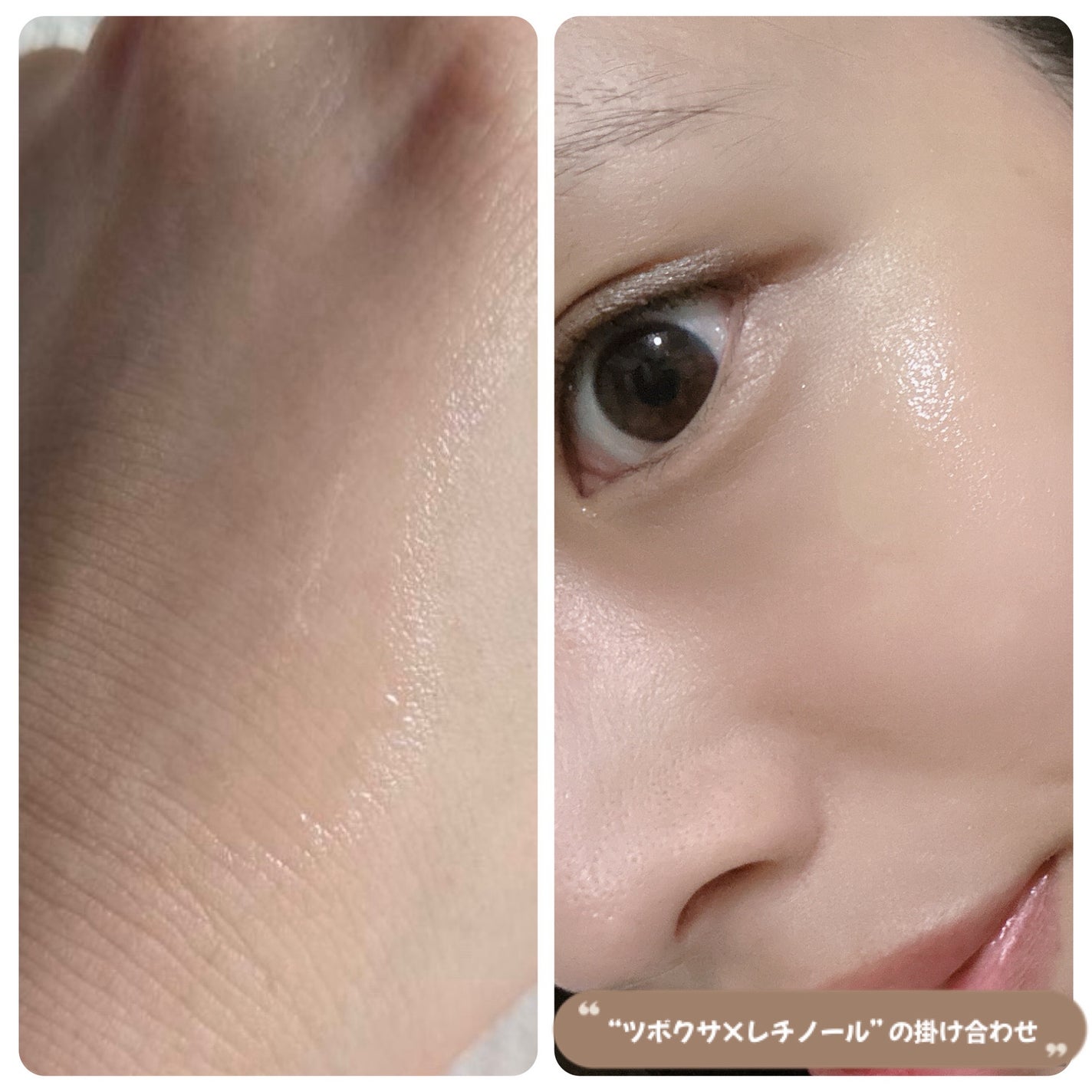 ビタ5Xシカチノールアンプルトナー/D'amu/化粧水を使ったクチコミ(2枚目)