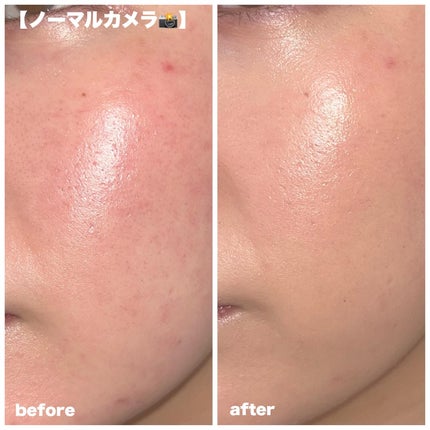 GLEAM COVERAGE CUSHION/BLANC DIVA/クッションファンデーションを使ったクチコミ(4枚目)