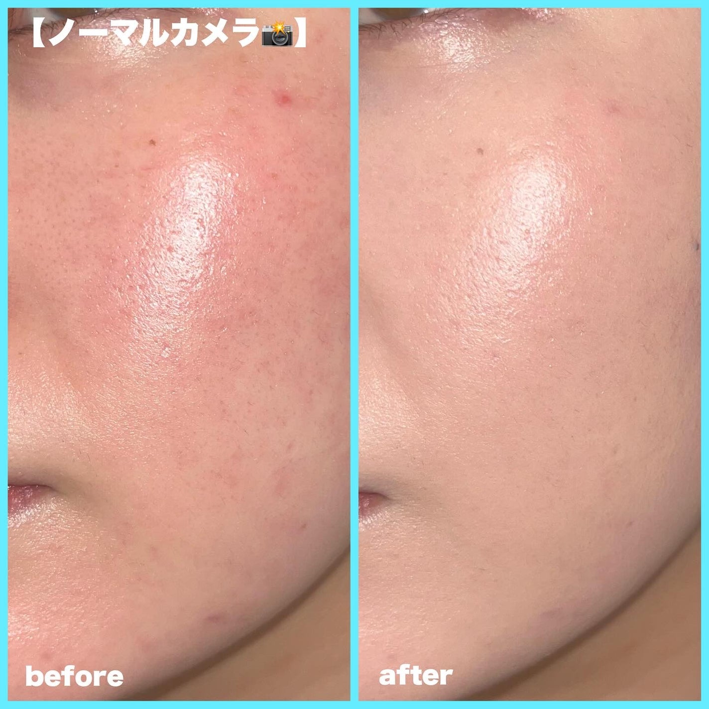 GLEAM COVERAGE CUSHION/BLANC DIVA/クッションファンデーションを使ったクチコミ(5枚目)