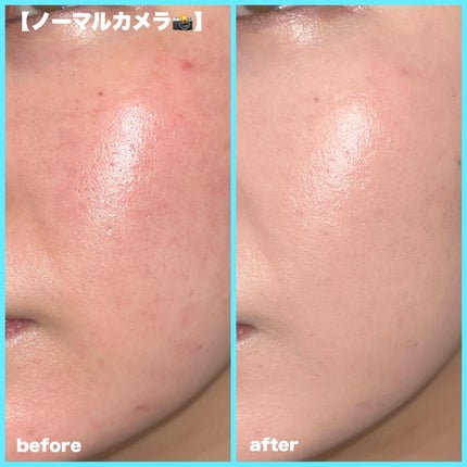 GLEAM COVERAGE CUSHION/BLANC DIVA/クッションファンデーションを使ったクチコミ(5枚目)