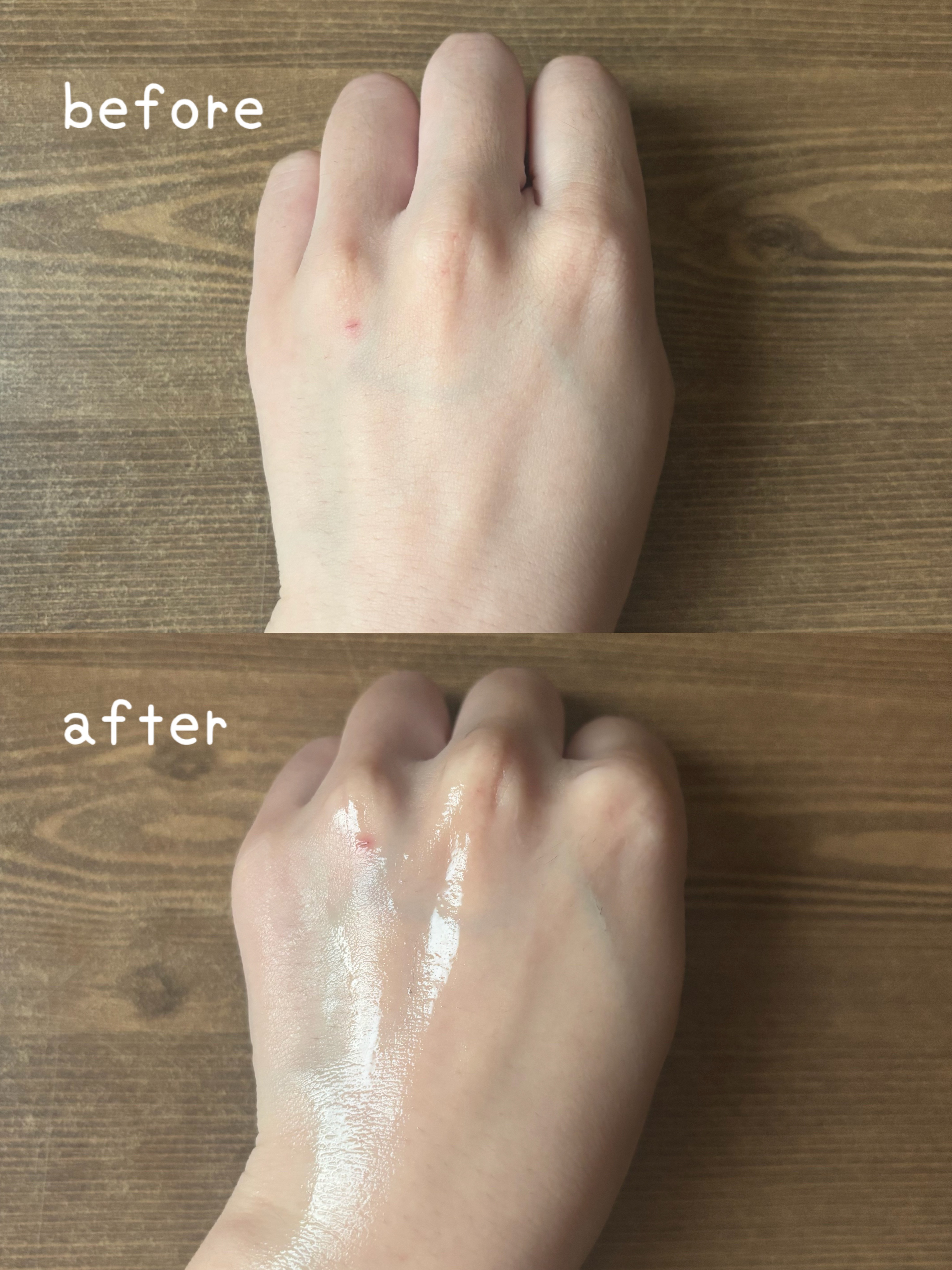 リデンス チェリートーン＆スポットコレクターアンプル/redence/美容液を使ったクチコミ（2枚目）