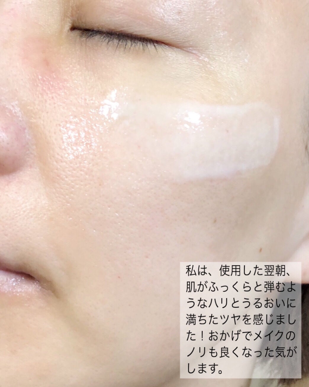 リードルS PDRN+ セラム/VT/美容液を使ったクチコミ(3枚目)