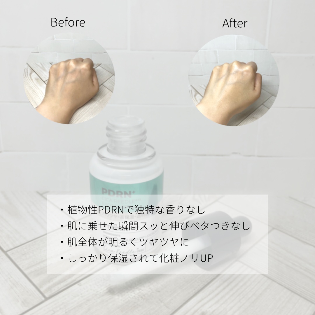 リードルS PDRN+ セラム/VT/美容液を使ったクチコミ（3枚目）