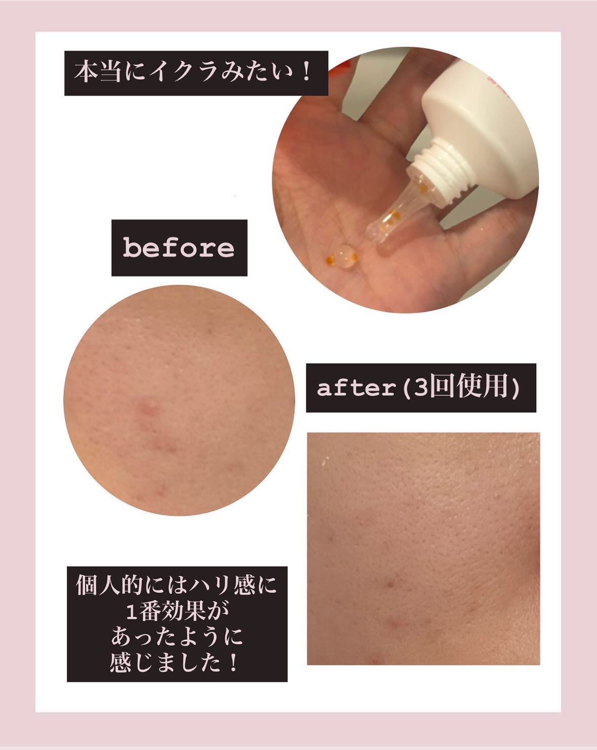 を使ったクチコミ（3枚目）