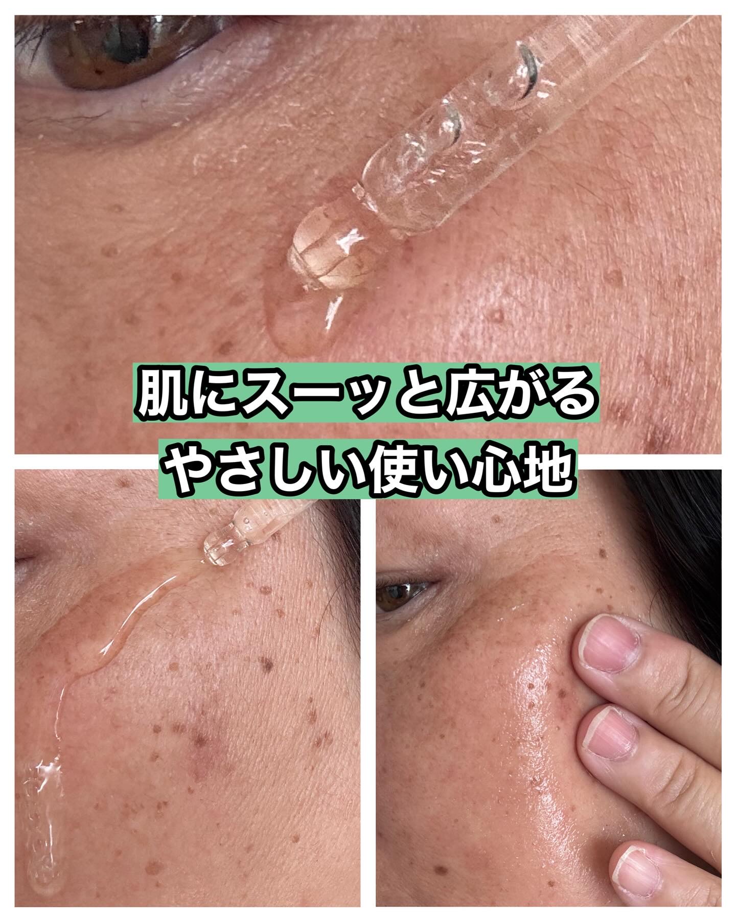 ノスカナイン トラブル セラム/FATION/美容液を使ったクチコミ（3枚目）