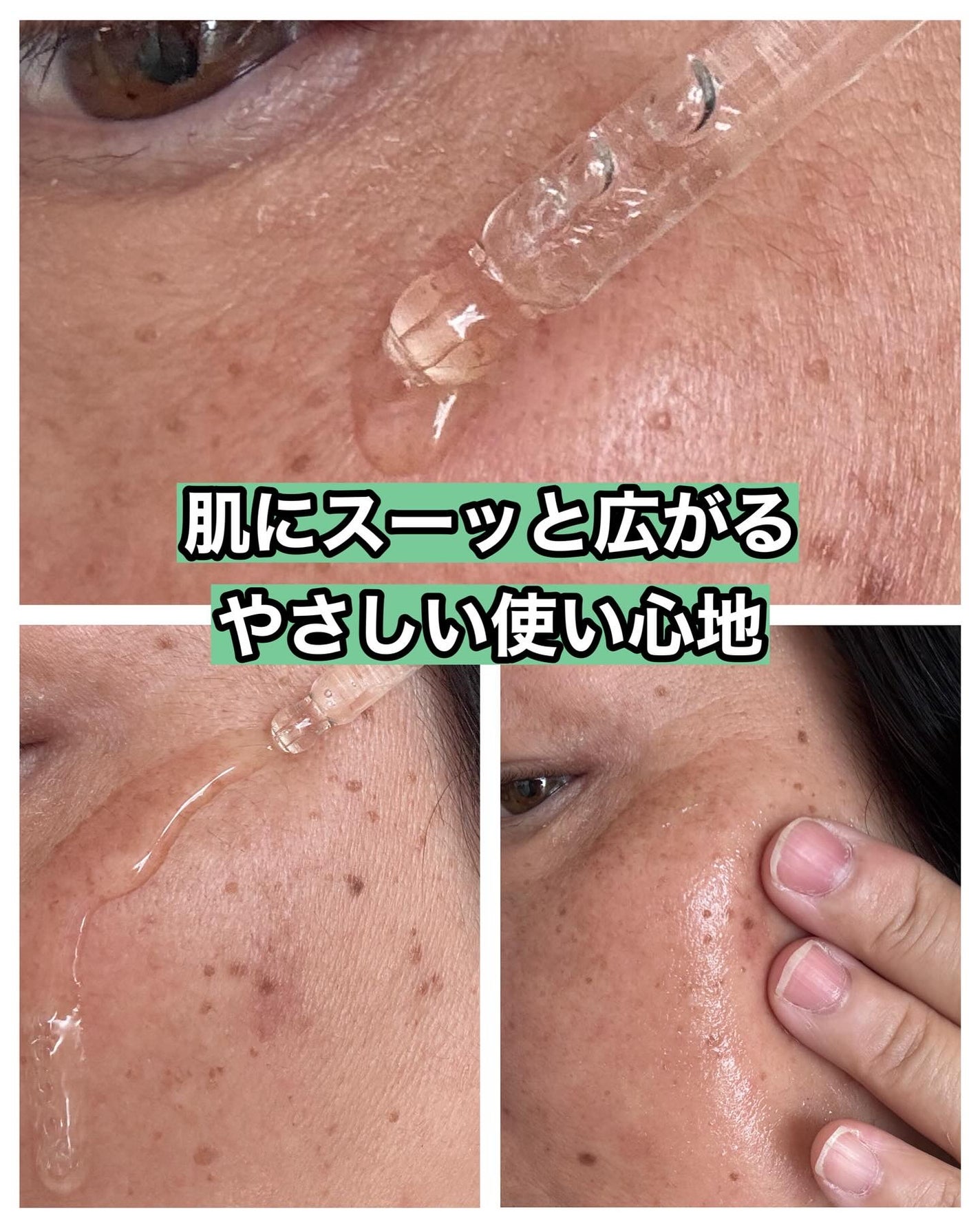 ノスカナイン トラブル セラム/FATION/美容液を使ったクチコミ(3枚目)