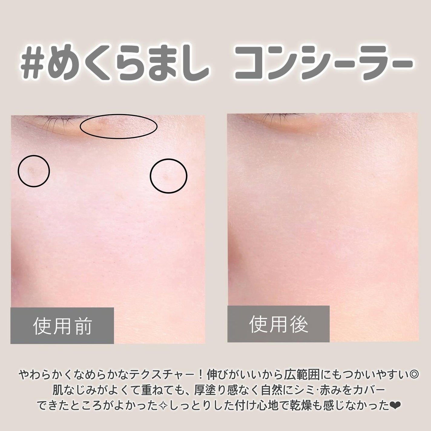 ディセンシア ハイカバーフィット コンシーラー/DECENCIA/リキッドコンシーラーを使ったクチコミ(4枚目)