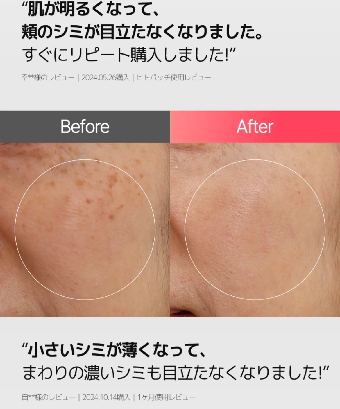 リデンス チェリートーン＆スポットコレクターアンプル/redence/美容液を使ったクチコミ（3枚目）