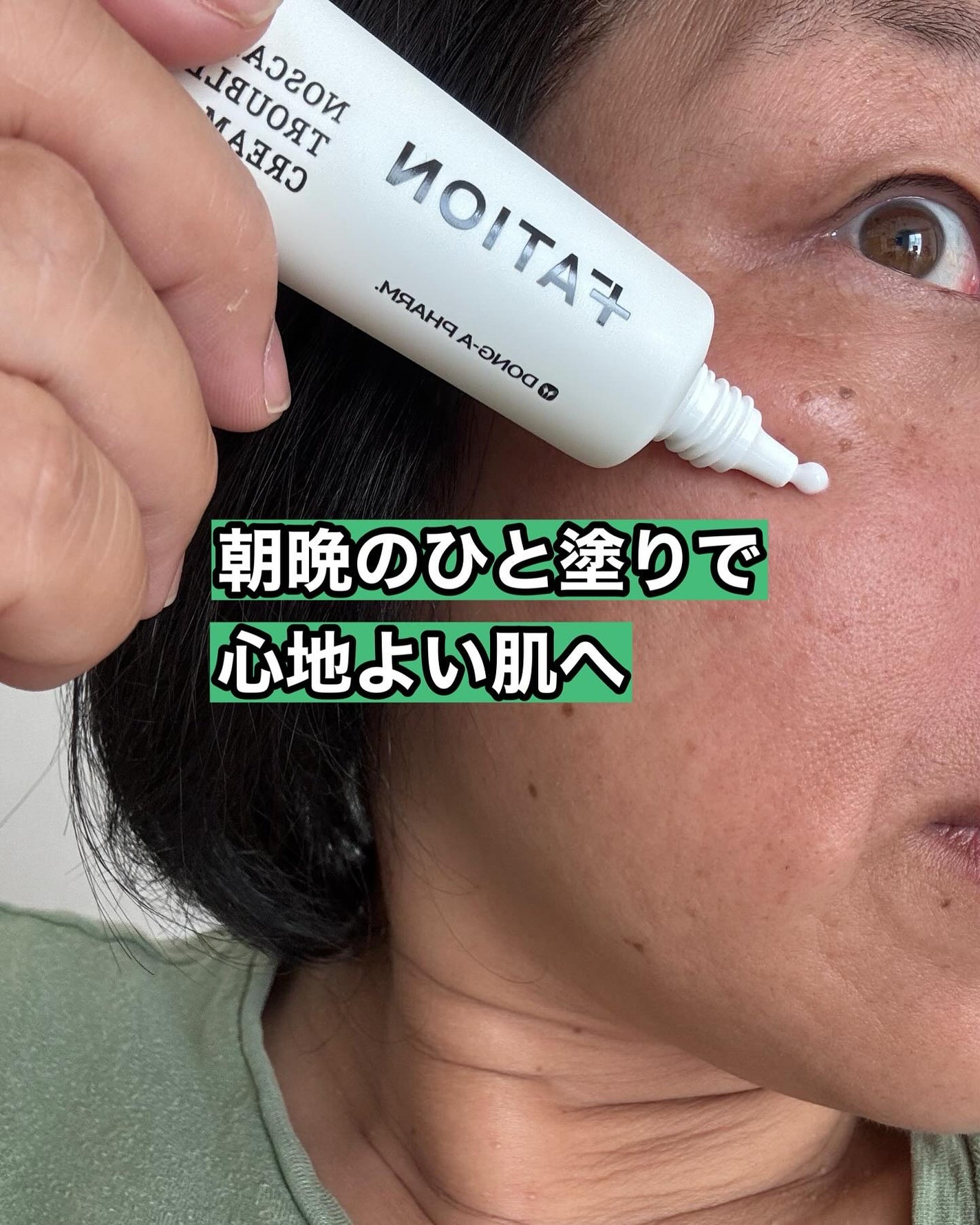 ノスカナイン トラブル セラム/FATION/美容液を使ったクチコミ(6枚目)