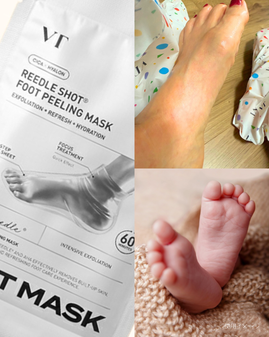 リードルショット リッチフットマスク/VT/レッグ・フットケアを使ったクチコミ（3枚目）