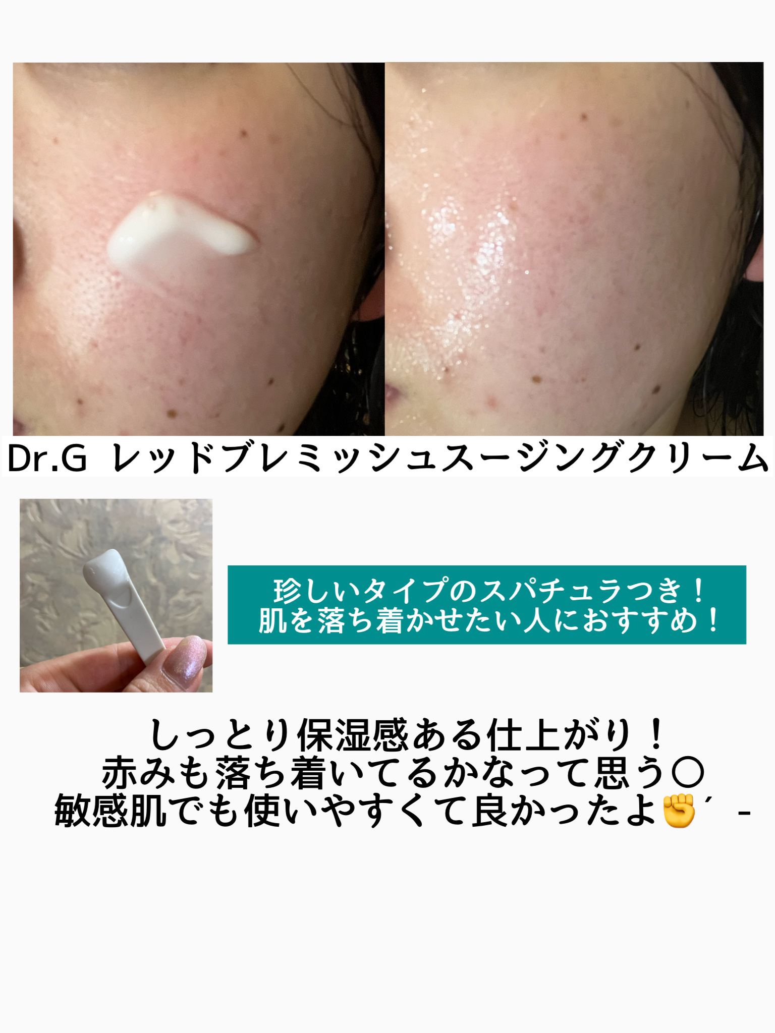 レッドブレミッシュ クリアスージングクリーム/Dr.G/フェイスクリームを使ったクチコミ（2枚目）