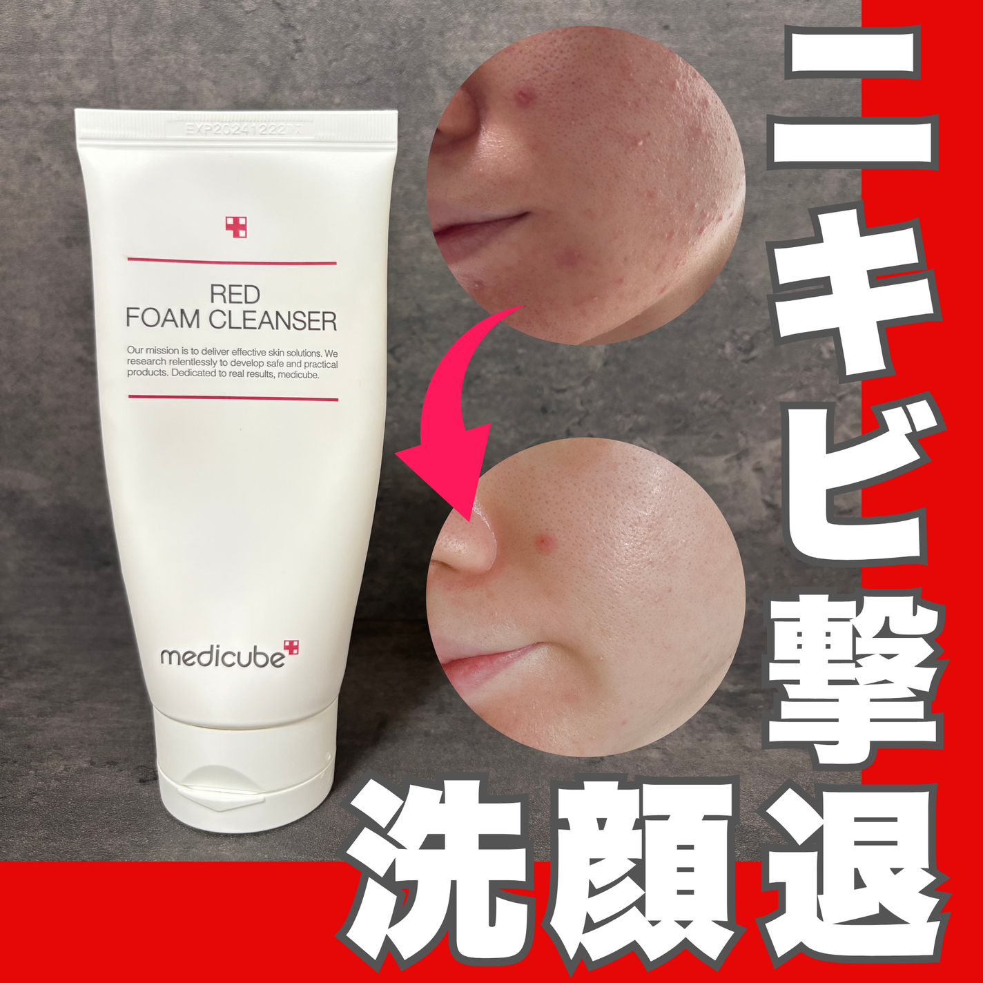 レッドクレンジングフォーム/MEDICUBE/洗顔フォームを使ったクチコミ(1枚目)