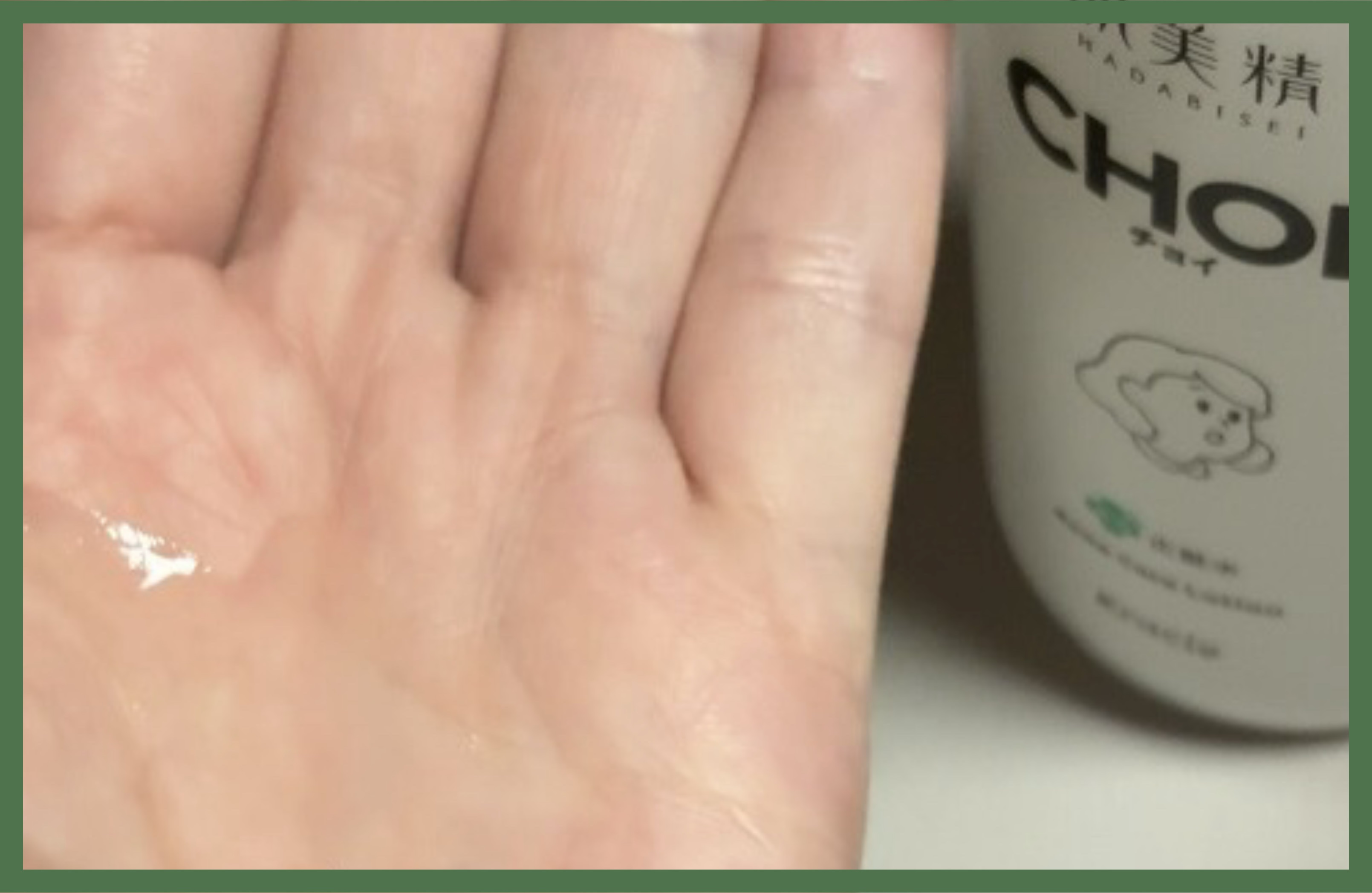 肌美精 CHOI薬用化粧水 ニキビケア[医薬部外品]/肌美精/化粧水を使ったクチコミ（3枚目）