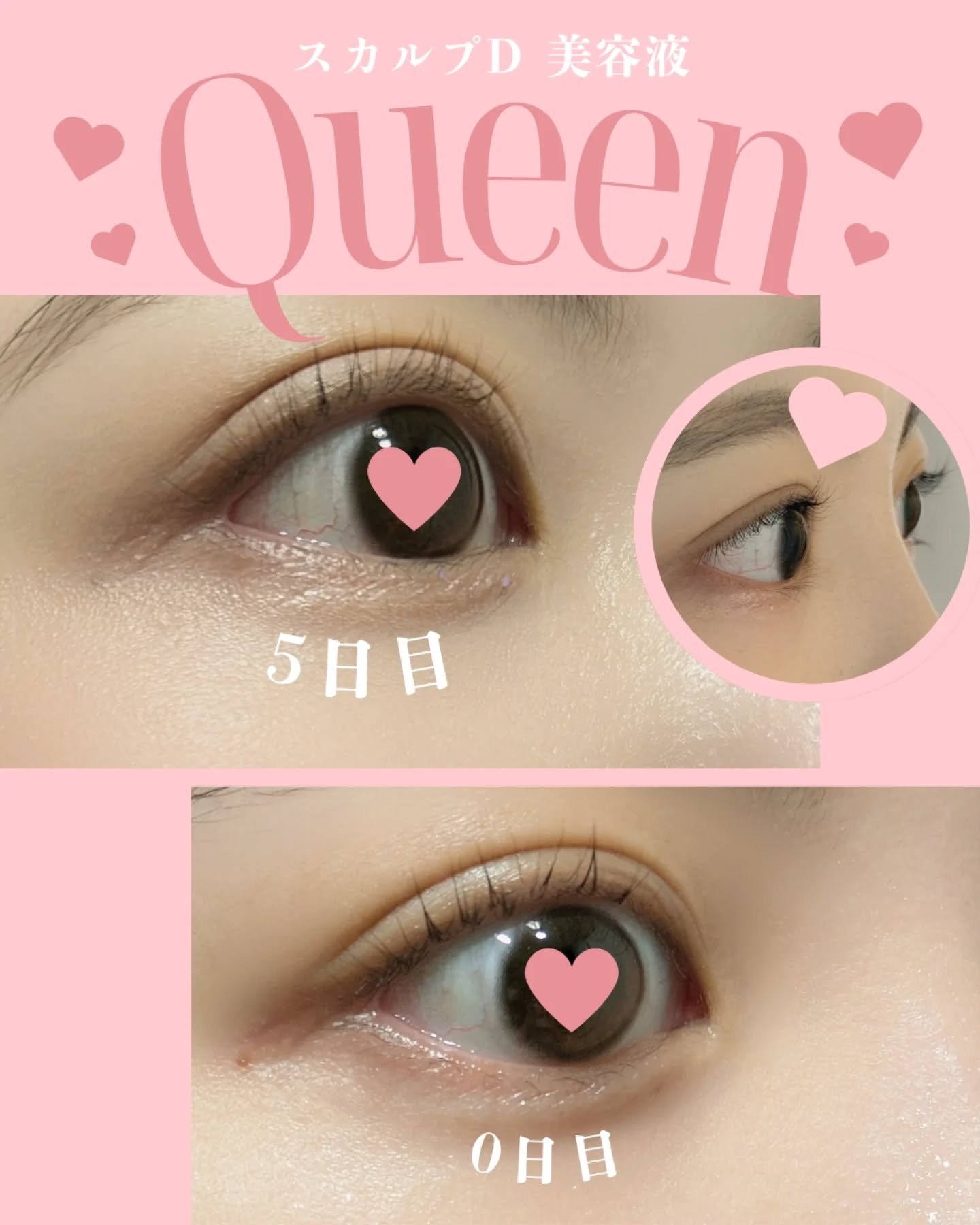 スカルプDまつ毛美容液　クイーン/アンファー(スカルプD)/まつげ美容液を使ったクチコミ（2枚目）