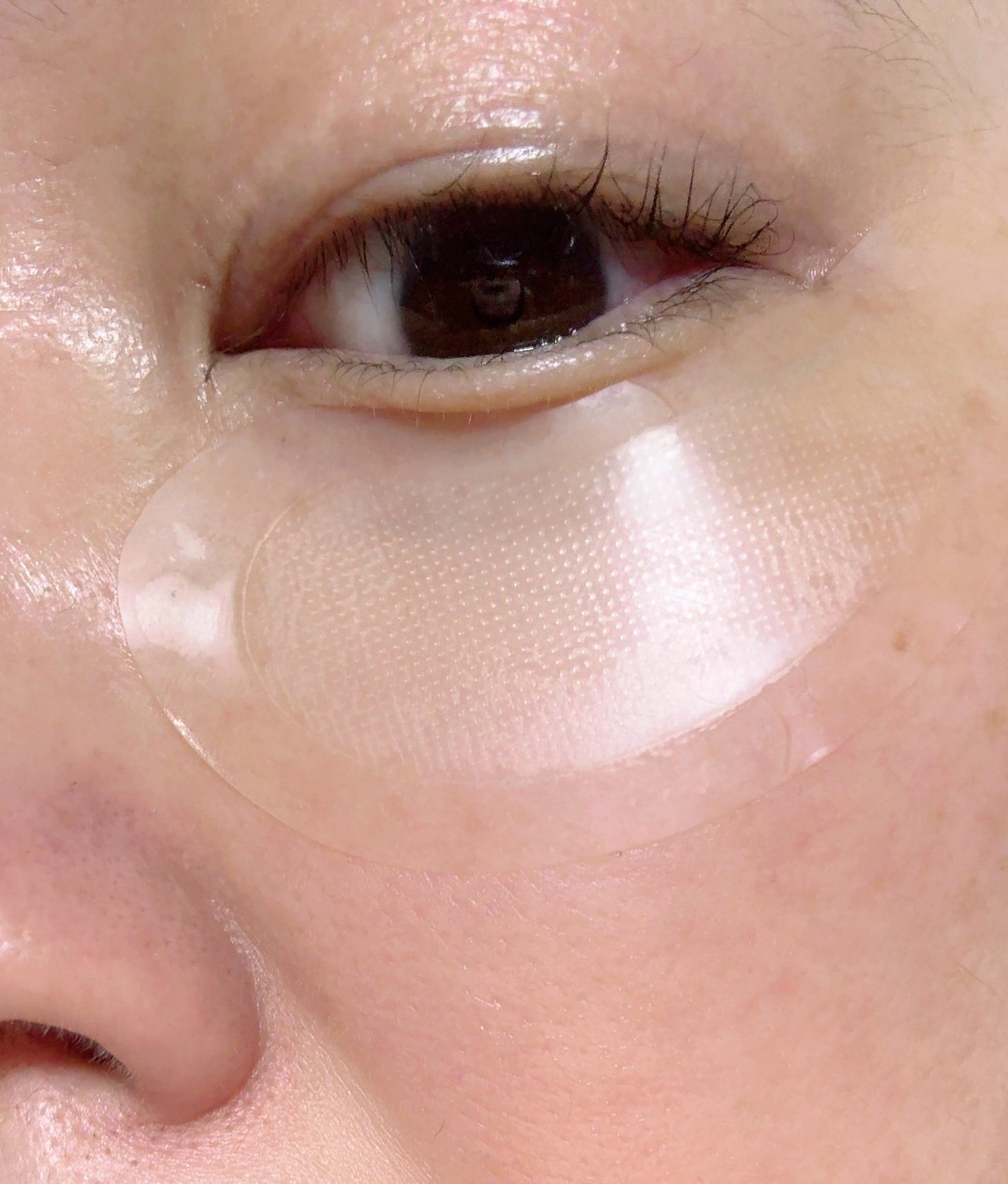 アイバックリフト1100シャットリードルパッチ/CHARDE/シートマスク・パックを使ったクチコミ(3枚目)