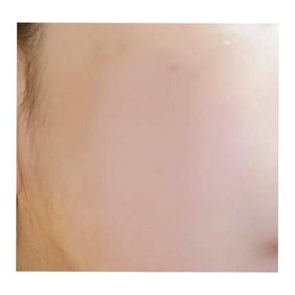 アトバリア365 ハイドロクリーム /AESTURA/フェイスクリームを使ったクチコミ(4枚目)