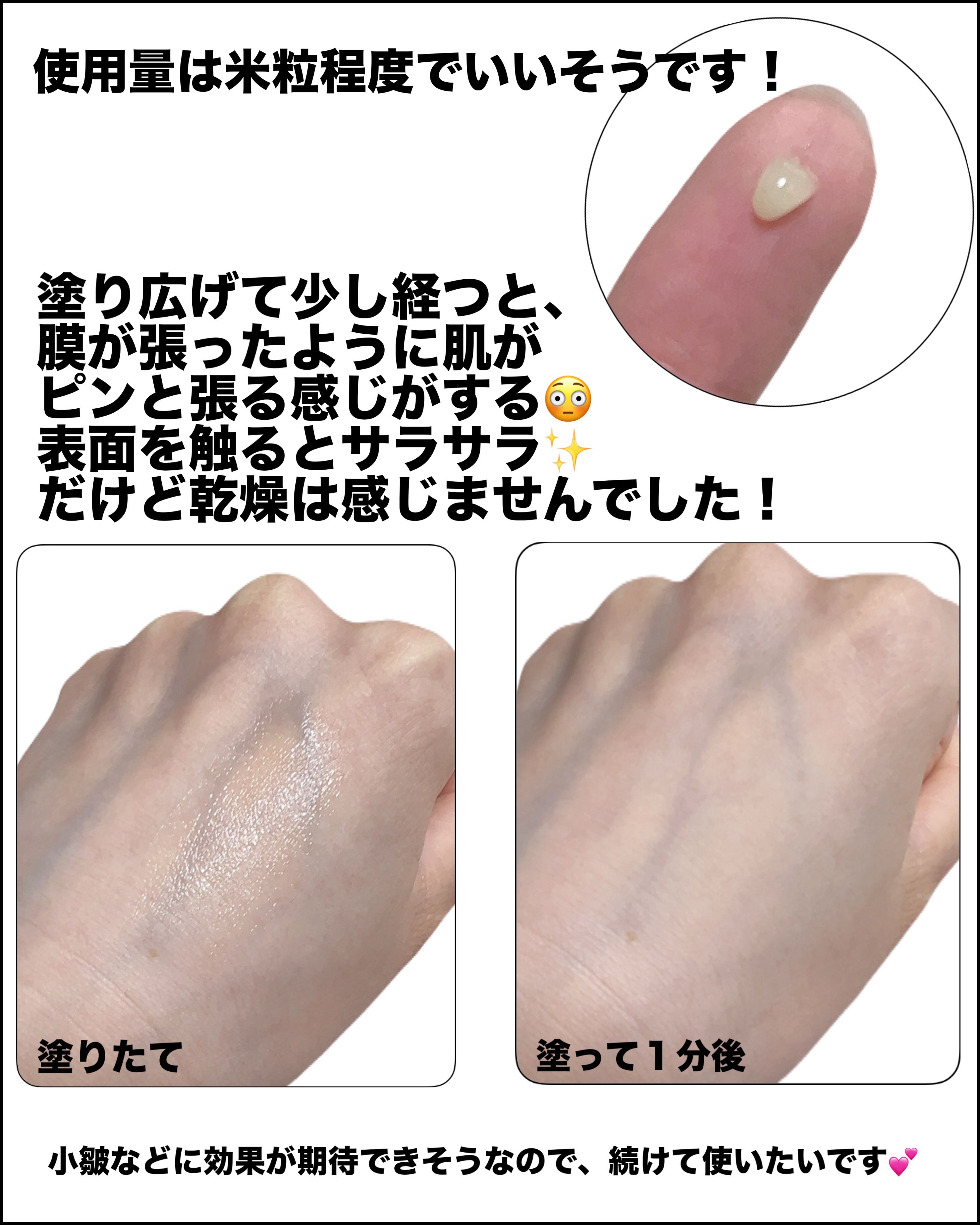 レチノールアイファルトアイバッククリーム/Dr.Melaxin/アイケア・アイクリームを使ったクチコミ（3枚目）