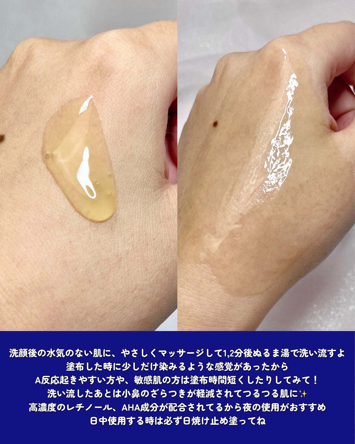 トリプル レチノール ウォッシュピール/Celladix/ピーリングを使ったクチコミ(4枚目)