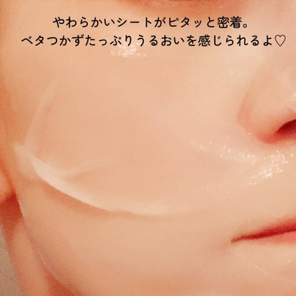ヒアルロンアクアアンプルマスクJEX/MEDIHEAL/シートマスク・パックを使ったクチコミ(7枚目)